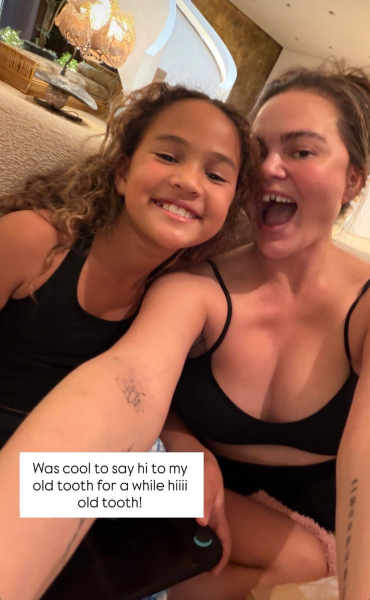 Chrissy Teigen with her daughter. Chrissy is missing one of her front veneers.